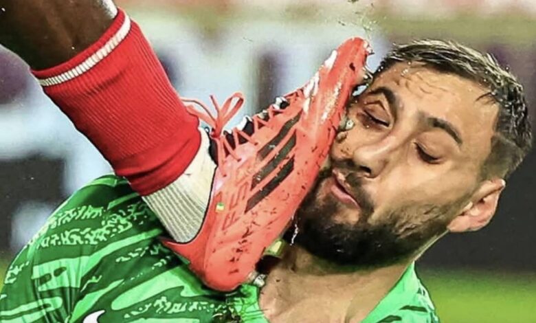 إصابة مروعة لحارس سان جيرمان دوناروما تتسبب في تشويه وجهه