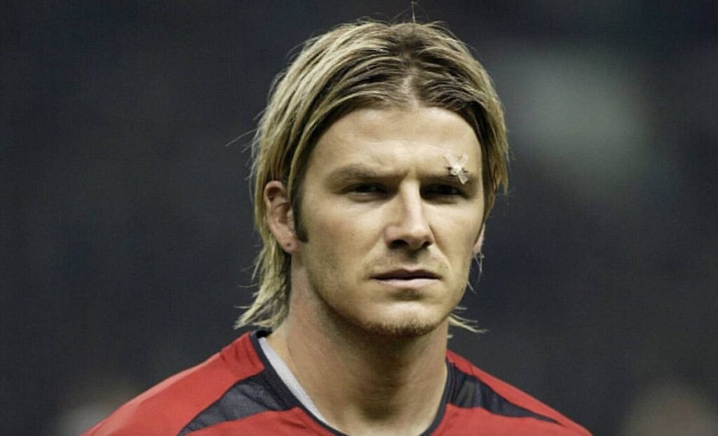 إصابة بيكهام أعلى العين بسبب شجاره مع السير أليكس فيرغسون عام 2003